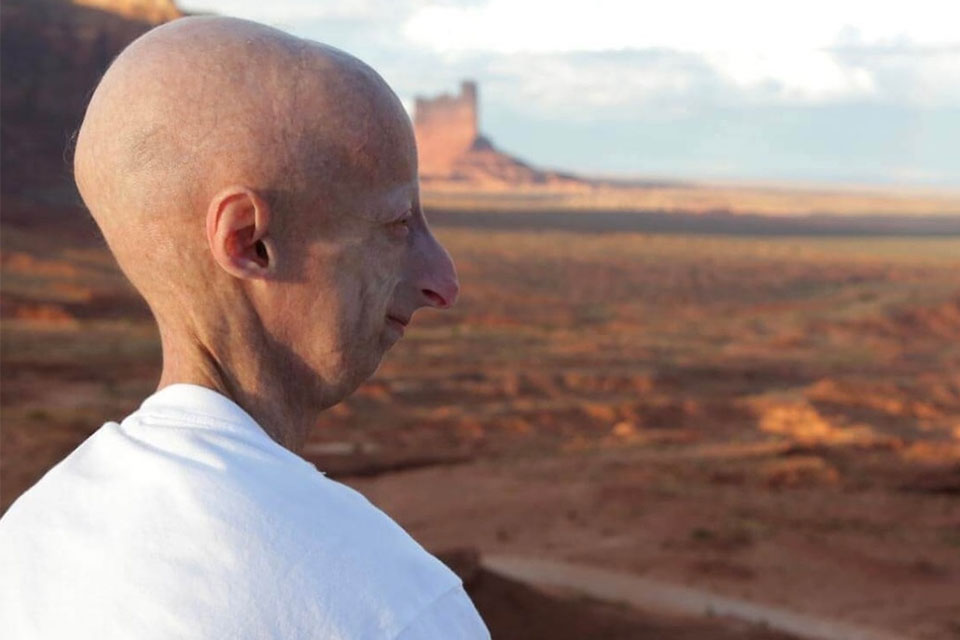 Siggi Group dedica a Sammy Basso la nuova collezione medicale e il camice “Sammy”